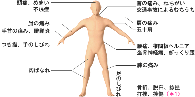 接骨院 さいたま市 北区日進町 こんな症状は田辺接骨院にご相談ください